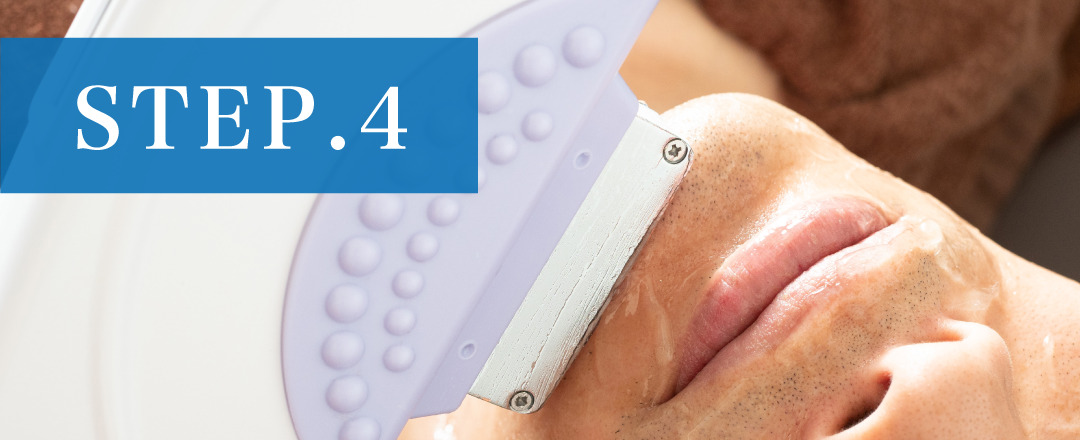 脱毛の流れ4